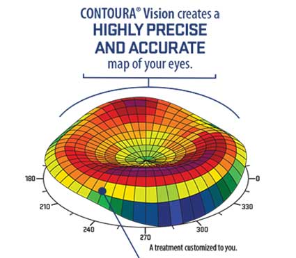 Contoura Vision Cost in Mumbai