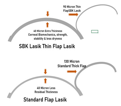 SBK thin flap Lasik vs Standard Lasik in mumbai